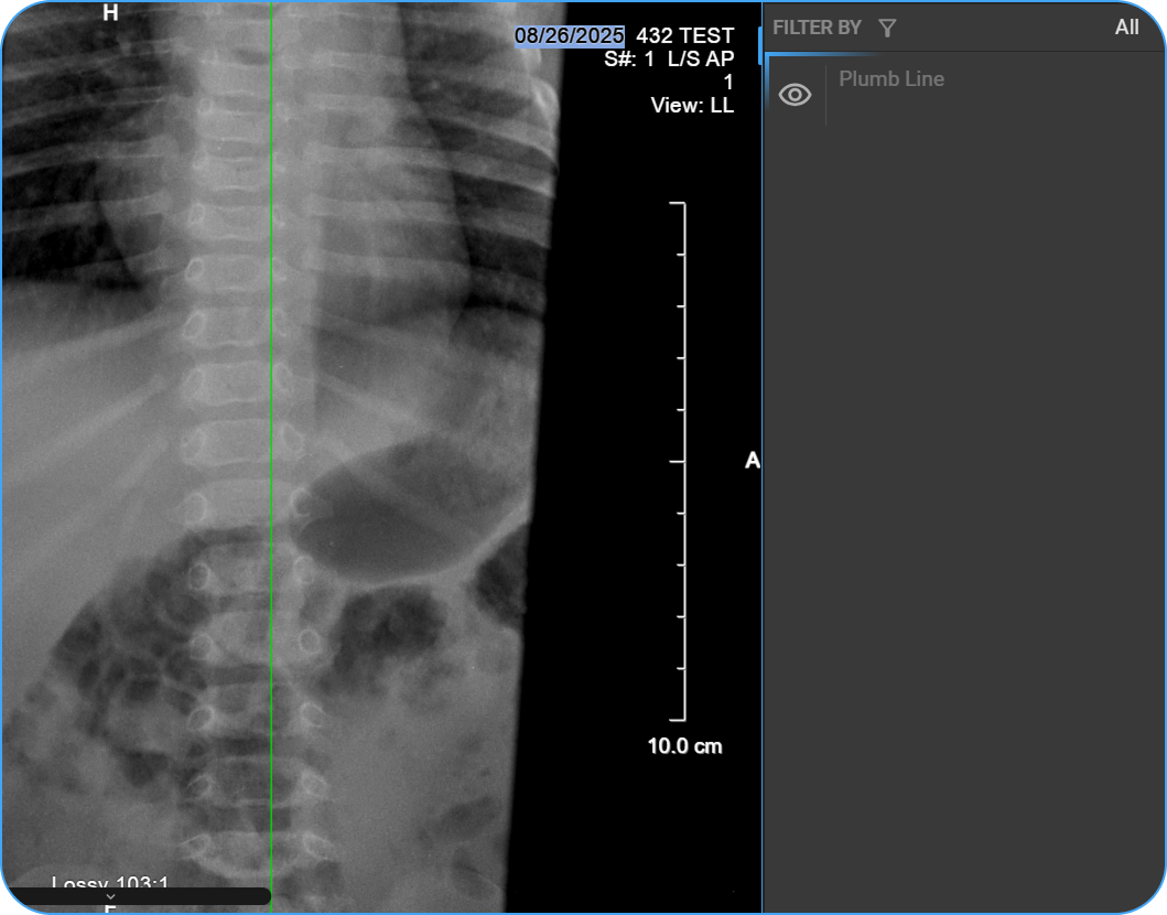 Plumb Line placed on image