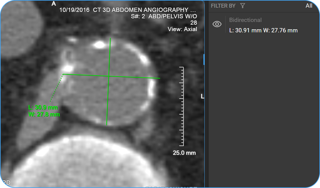 Bidirectional measurement placed on image