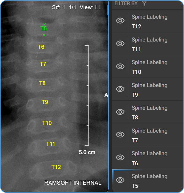 Spine labels placed on image