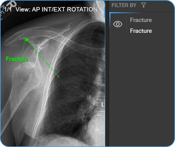 Annotate arrow placed on image