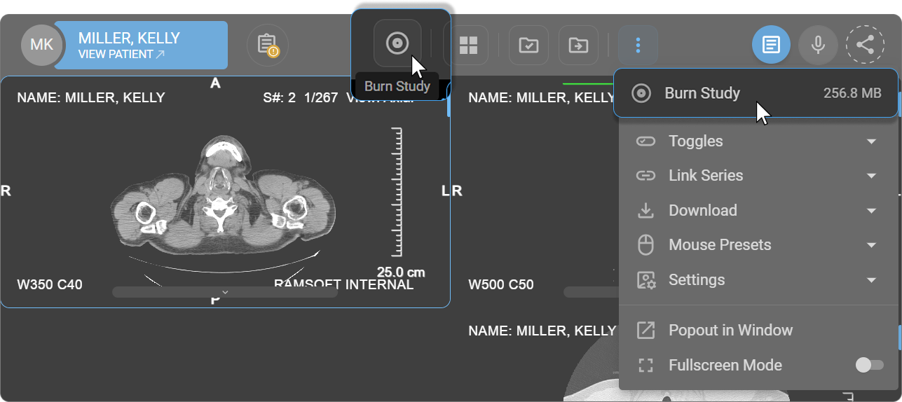 Burn Study access from toolbar and More Options menu