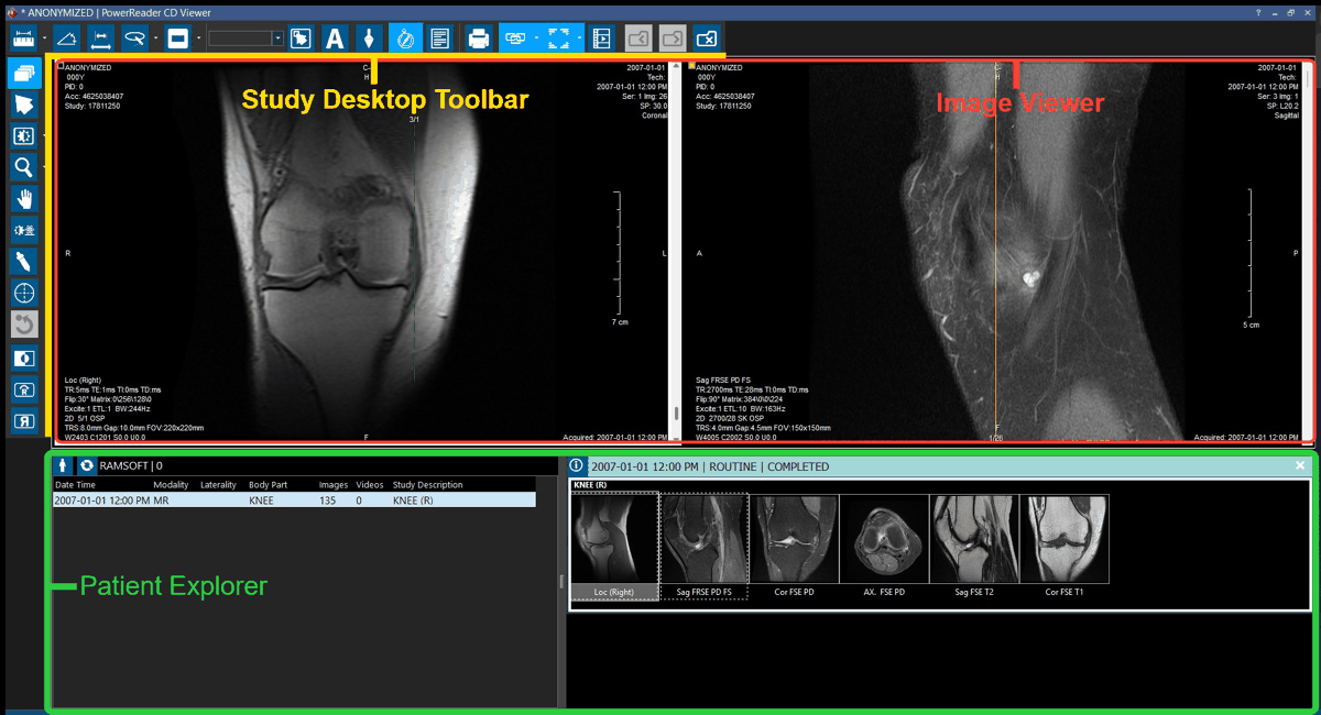 Study Desktop layout: Toolbar, Image Viewer, and Patient Explorer