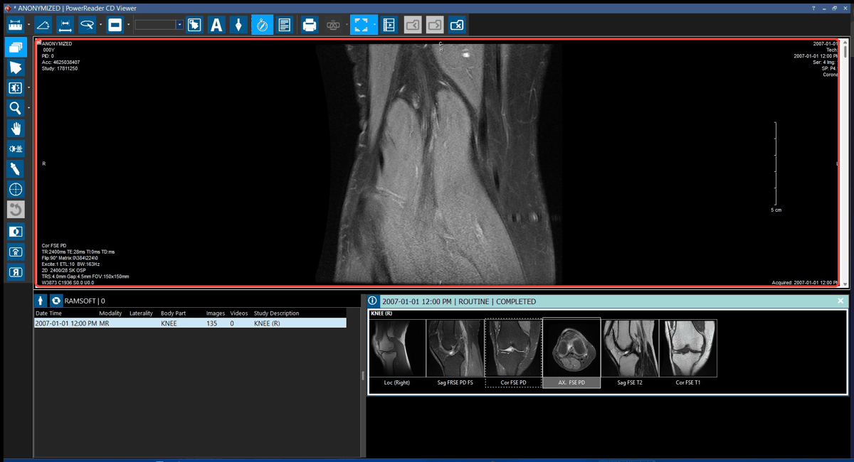 Returning a viewport to its default size