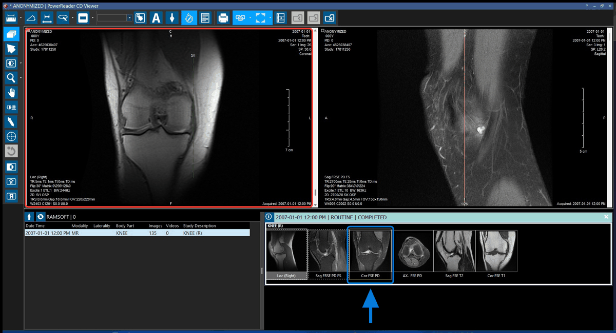 Replacing a viewport via thumbnail