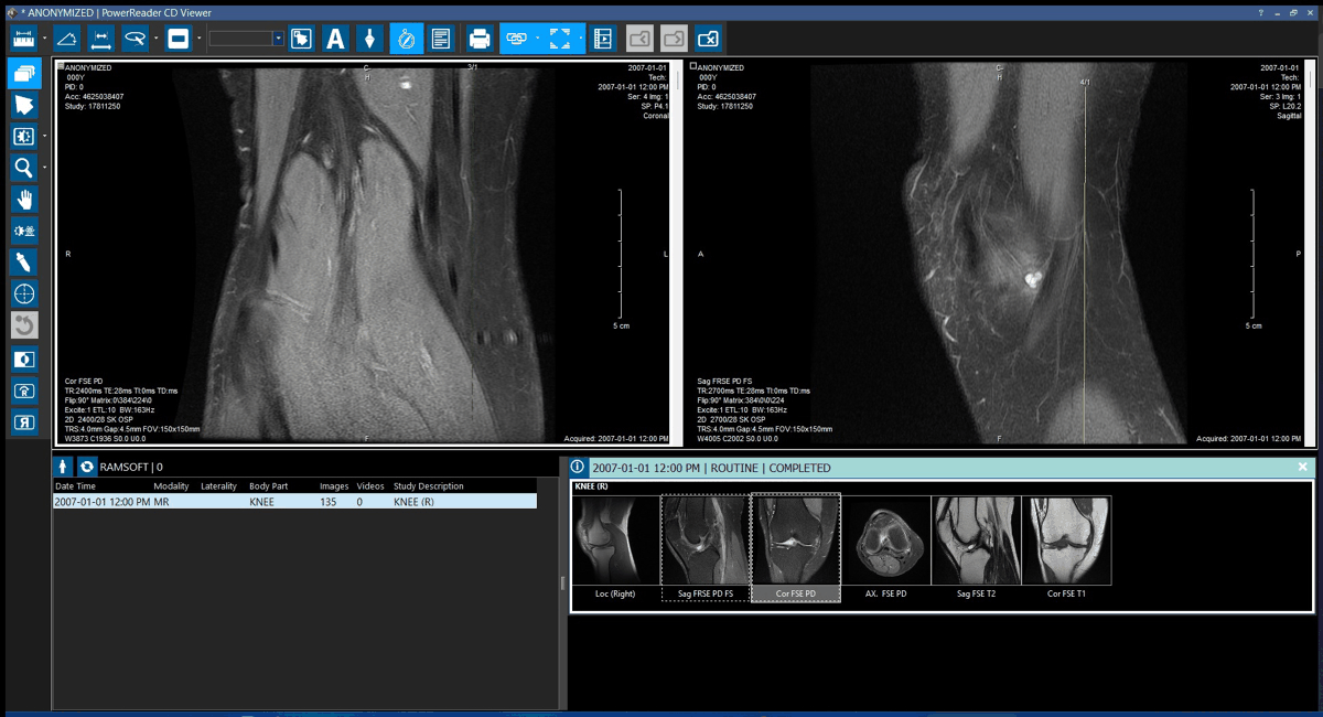 Viewport after replacement