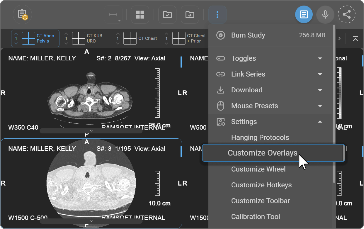 Accessing Customize Overlays from More Options menu