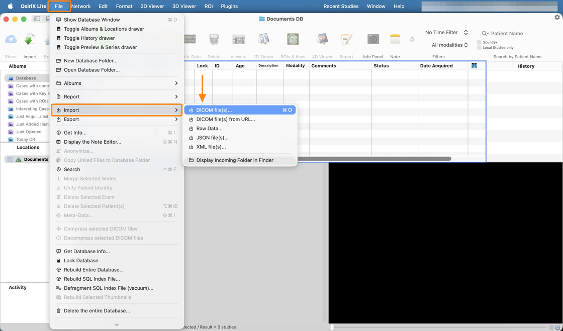 Opening files in OsiriX