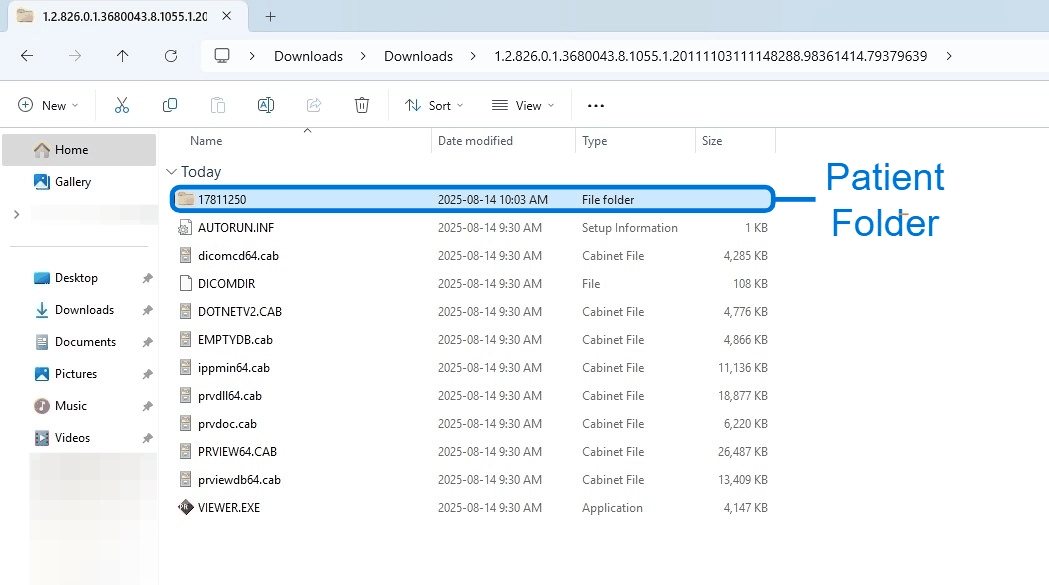 Extracted study folder showing the patient folder