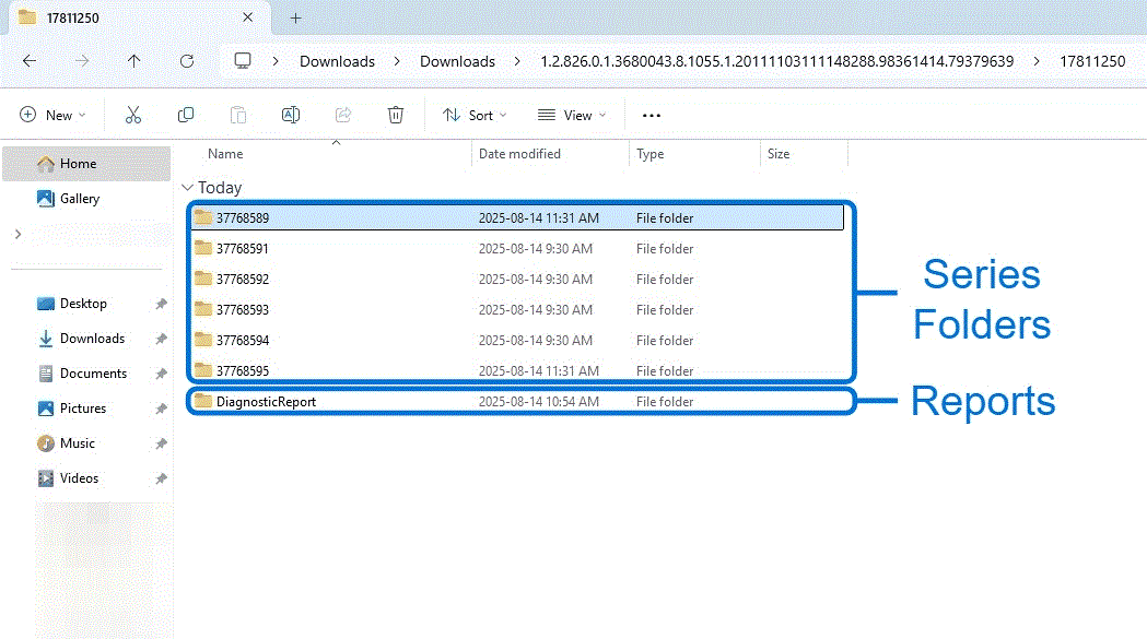 Inside a patient folder: Series folders and the DiagnosticReport folder