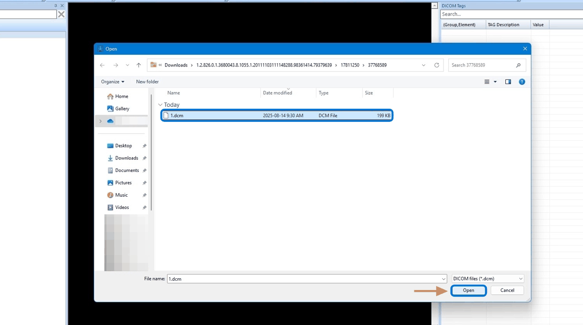 Selecting the renamed 1.dcm file from the viewer's Open dialog