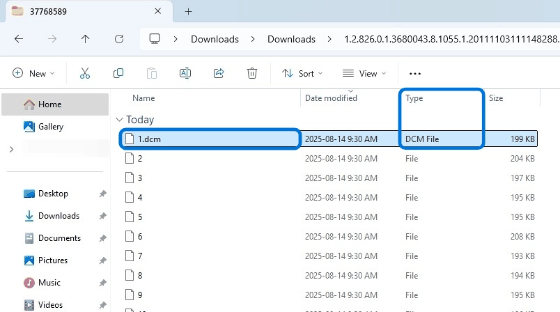 File renamed to 1.dcm with type DCM File