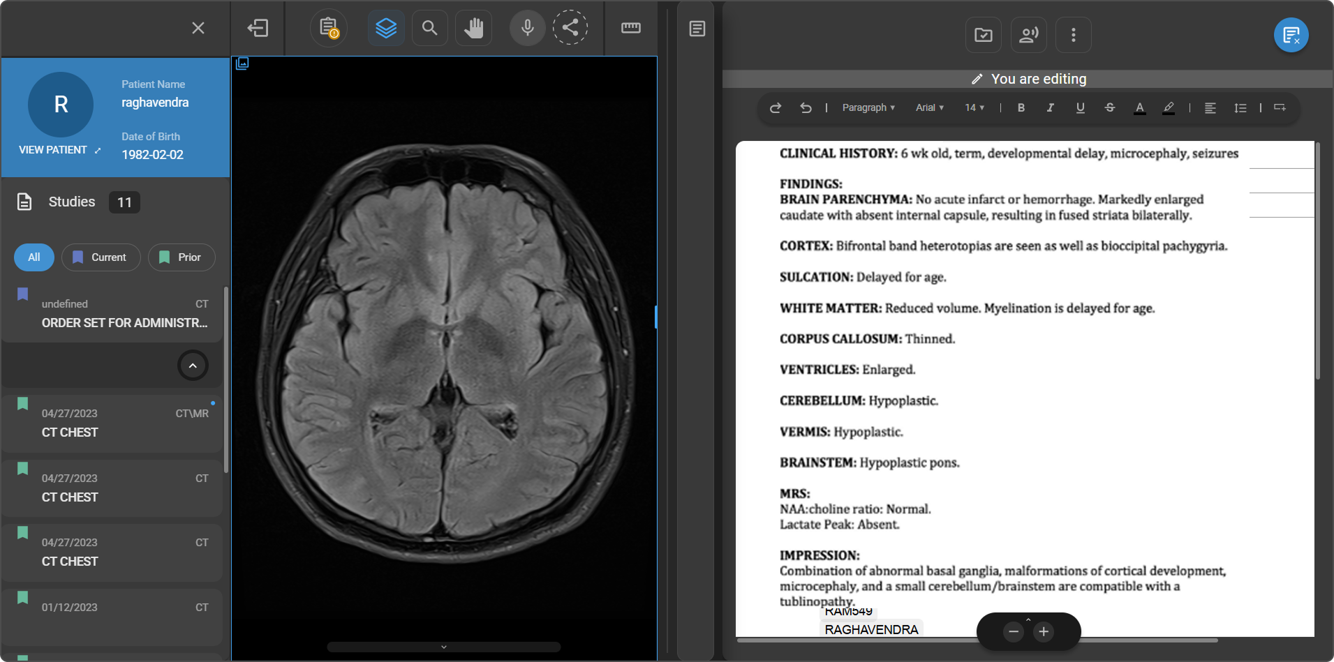 Document Viewer panel open on the right, beside the imaging study