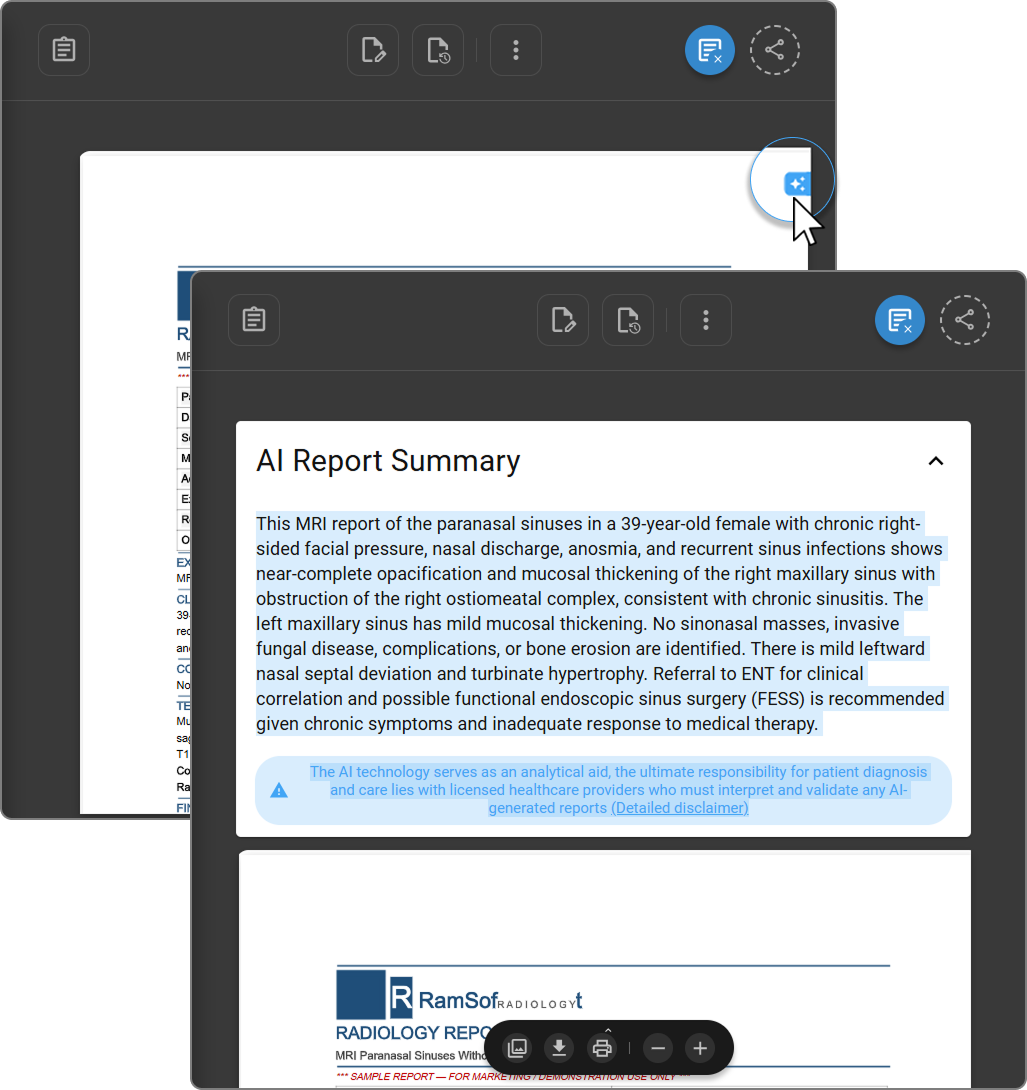 AI Report Summary panel with disclaimer