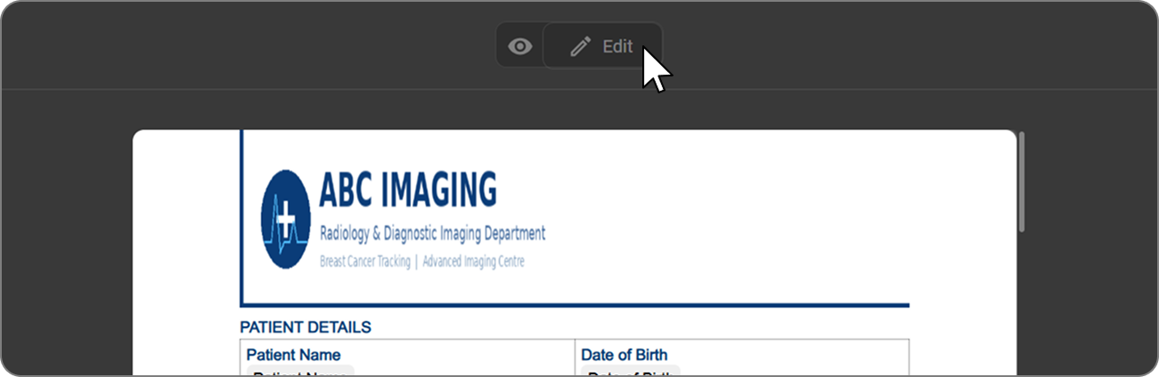 Editing a Template