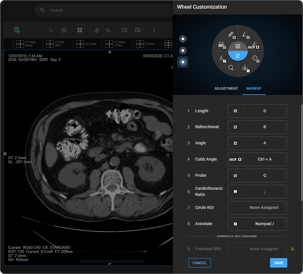 Wheel Customization drawer open on the right side of the screen