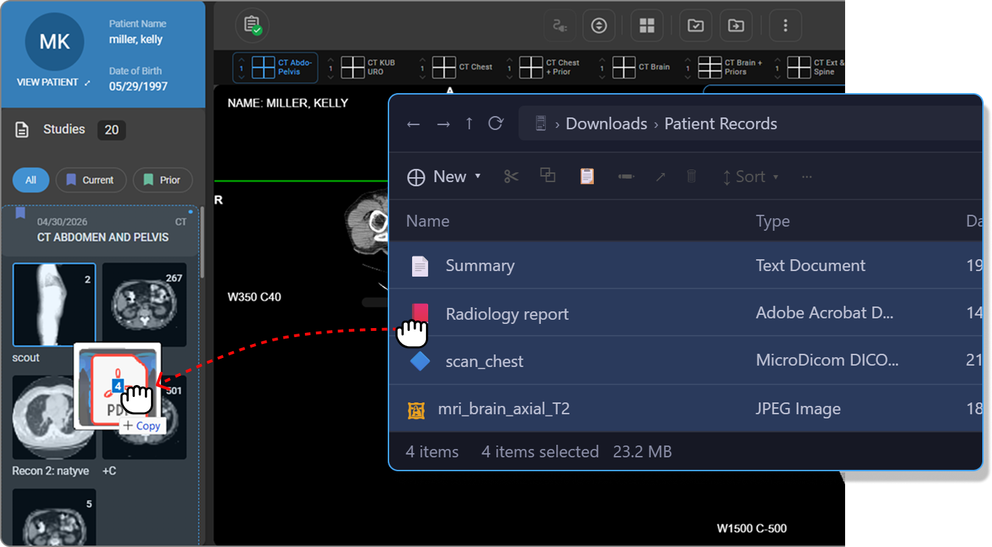 Dragging and dropping selected files onto a study card in the Study Explorer panel