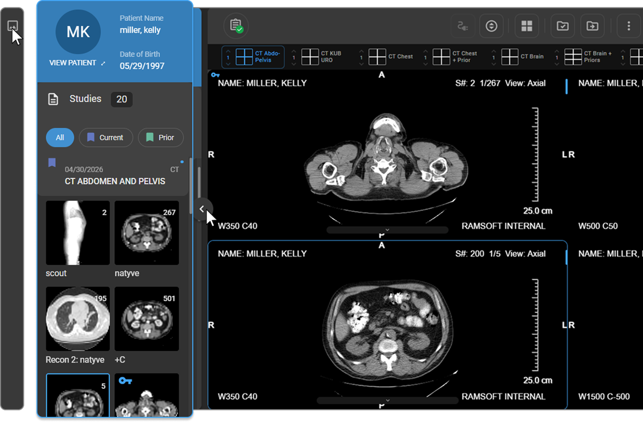 Study Explorer panel expanded, showing study and series thumbnails