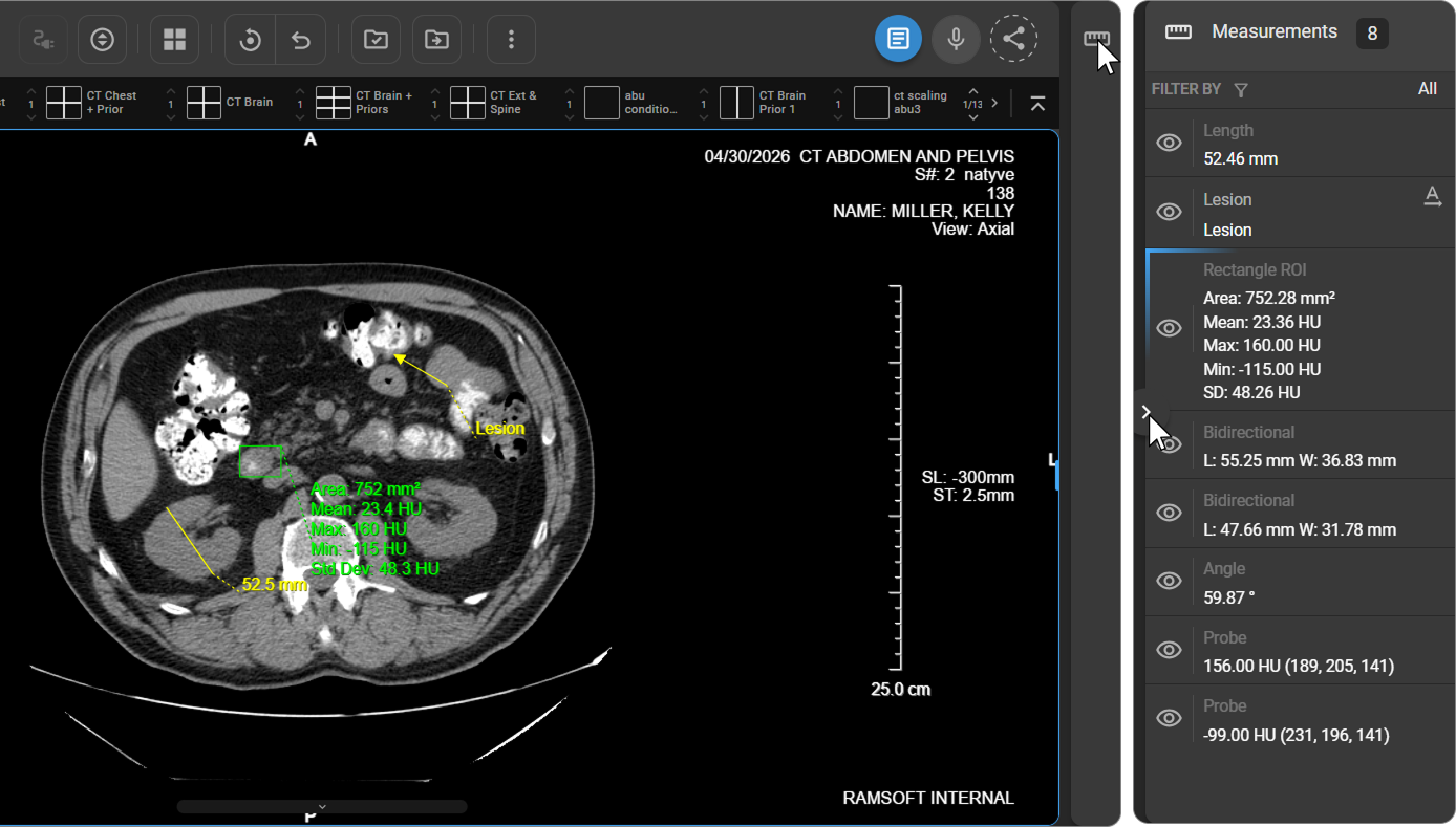 Measurement Panel expanded in the Image Viewer
