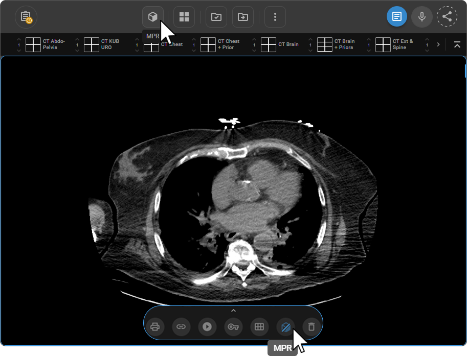 MPR button location in the Viewport Menu