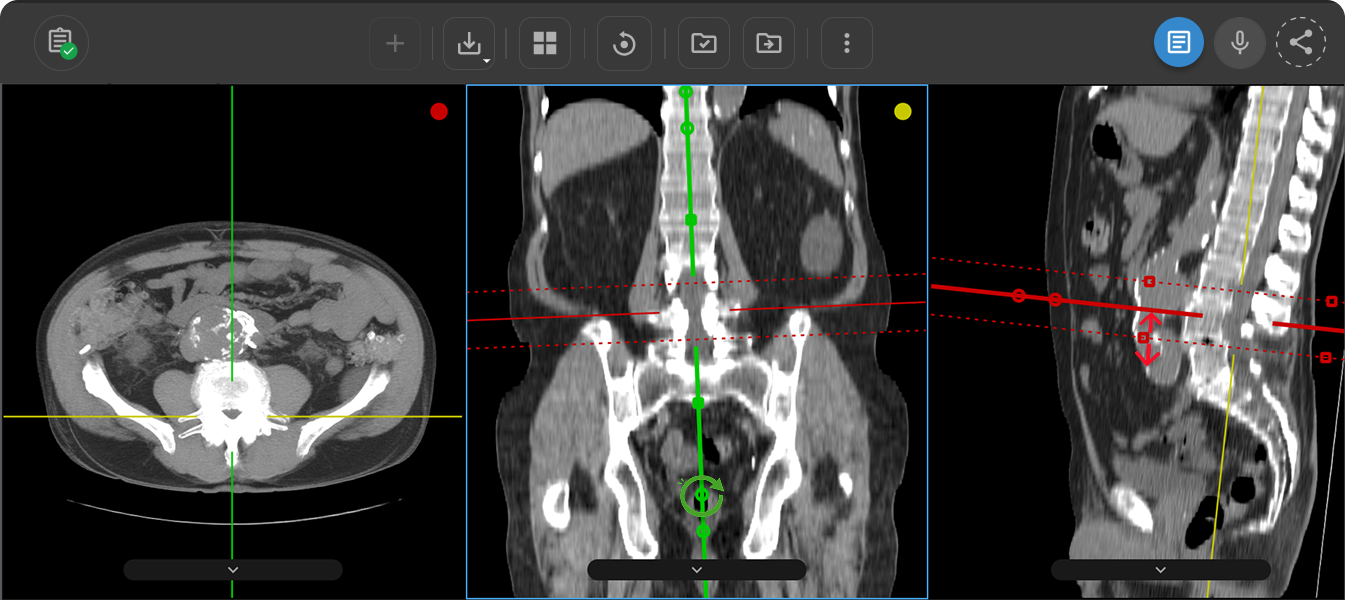 Interactive nodes (square and circular) along a crosshair line