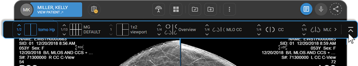 Quick Access Strip showing hanging protocol tiles below the main toolbar