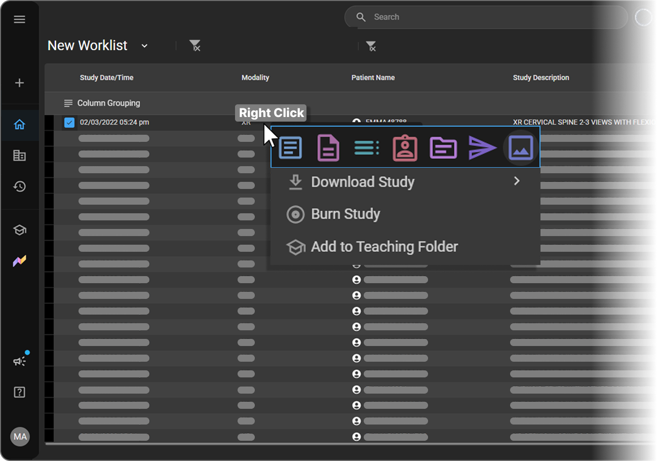 Right-click shortcut menu on a Worklist study row