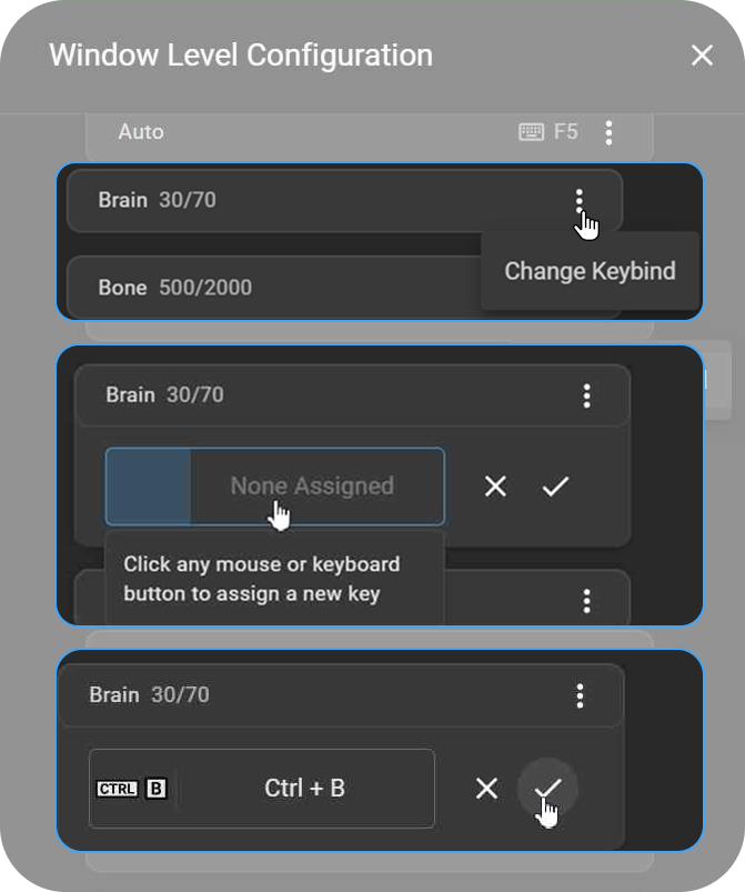 Keybind assignment