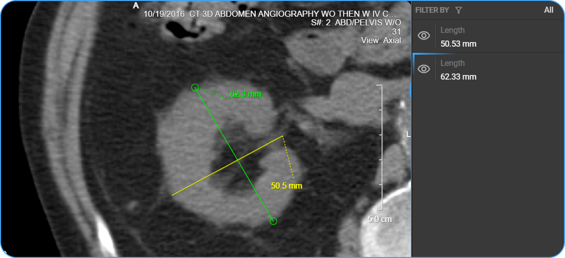 Length measurement placed on image