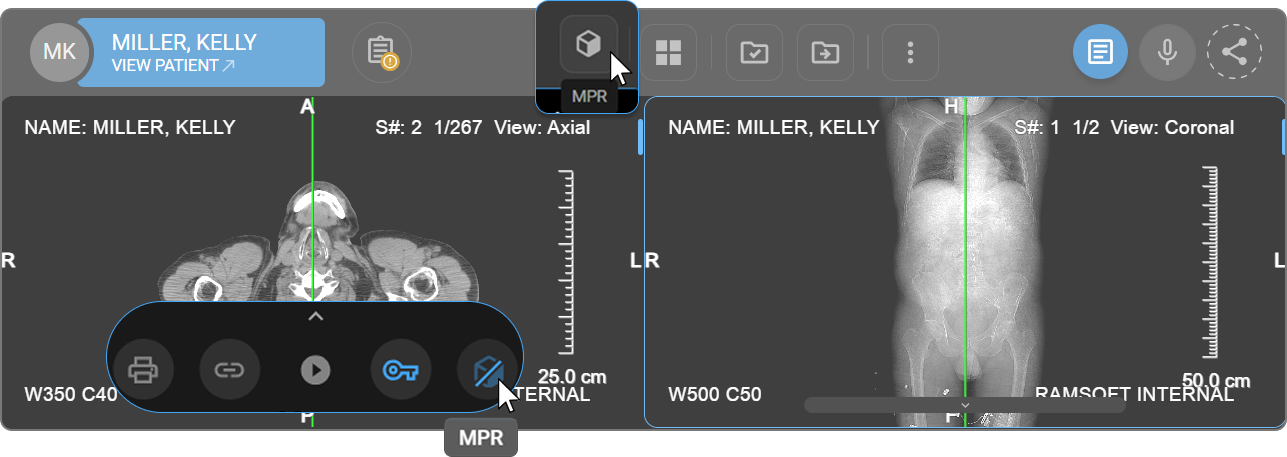 Icono de MPR en el menú de la ventana de visualización