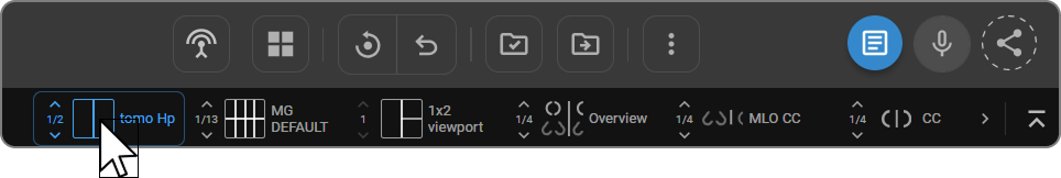Image placeholder: Quick Access Strip showing mammography hanging protocol tiles below the main toolbar