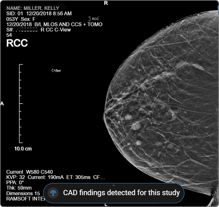 Image placeholder: CAD findings notification banner displayed at the bottom of the viewport