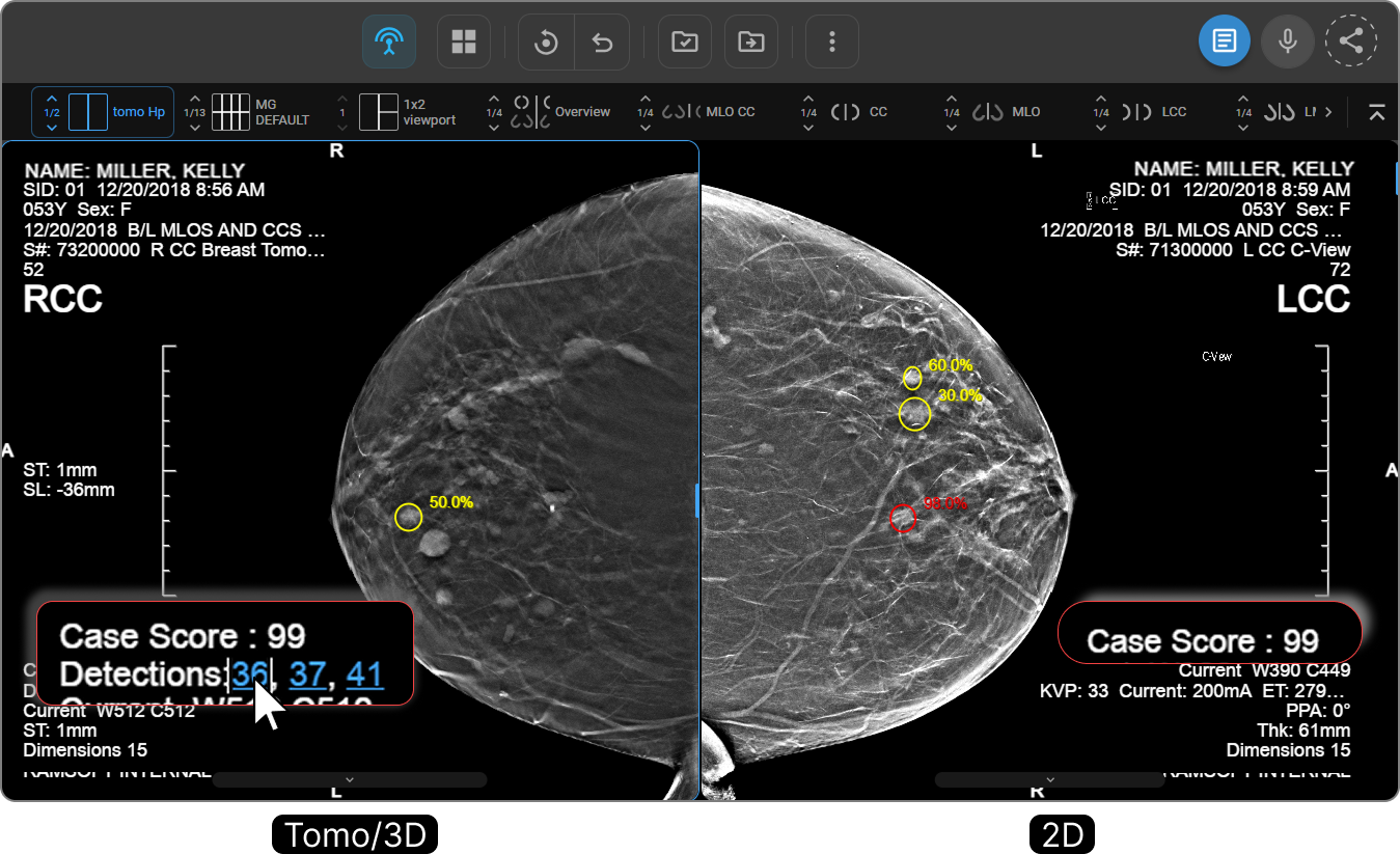 Image placeholder: Viewport overlay showing CAD annotations — Case Score and Detections hyperlinks at the bottom