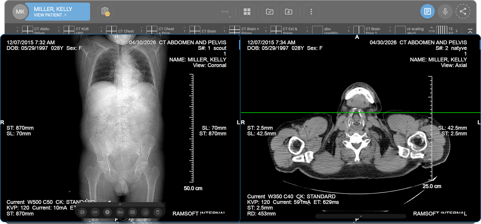 Viewport area displaying a medical imaging study with overlay annotations