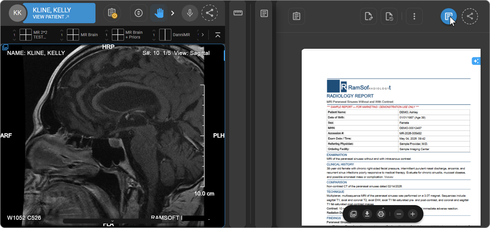 Embedded Document Viewer open alongside the imaging study
