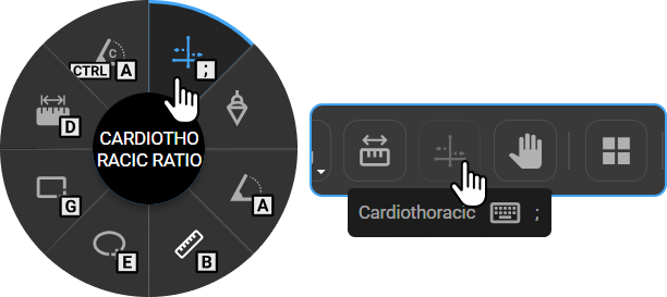 Cardiothoracic Ratio tool