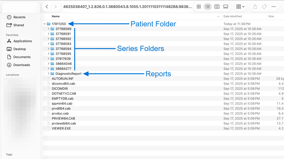 Patient folder contents on macOS