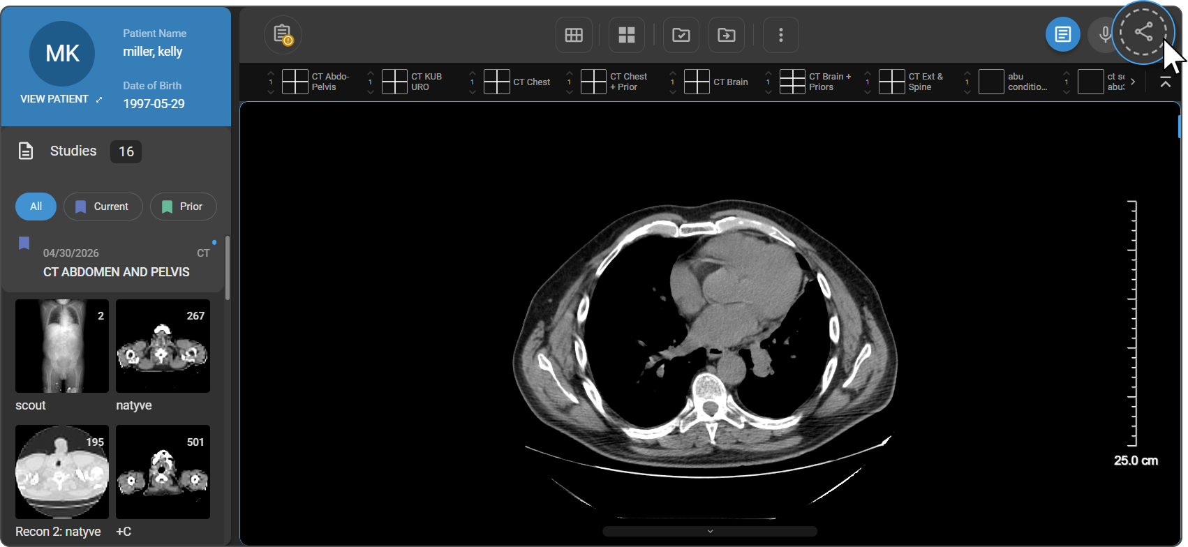 Image Viewer – Share icon in top-right corner of toolbar