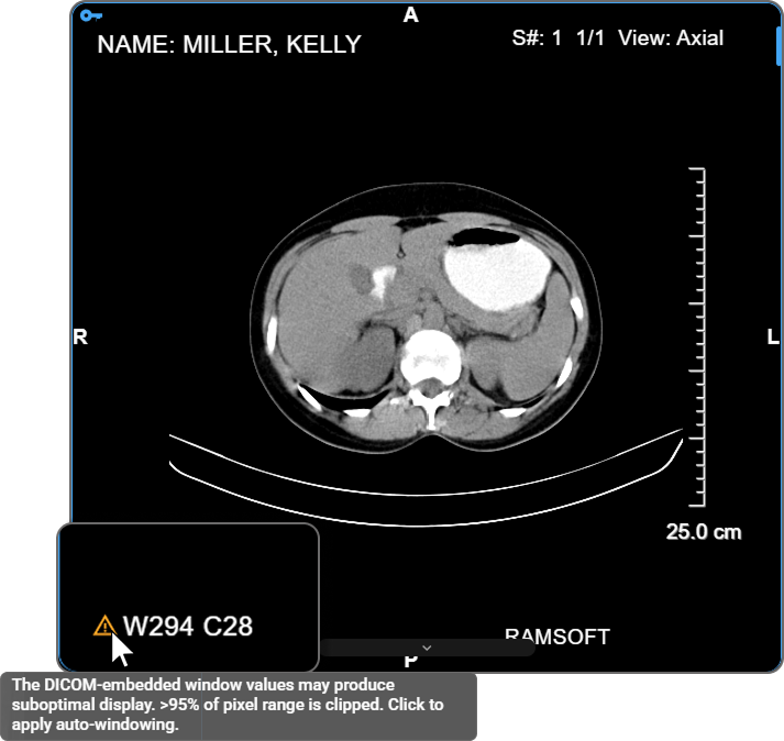 DICOM window/level warning icon and tooltip